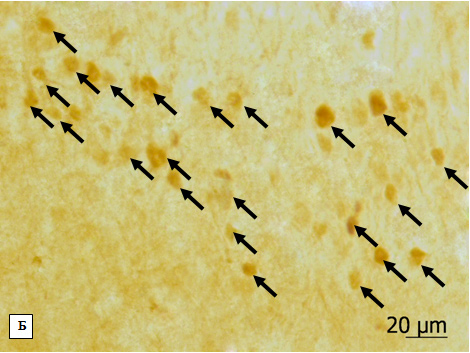 Микрофотографии фрагментов пириформной коры крыс