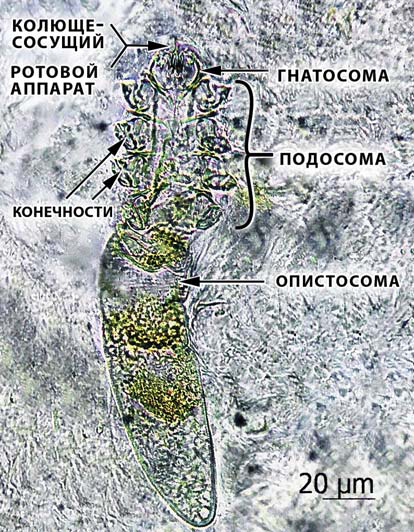 Микрофотография подвижных частей тела клеща D. folliculorum