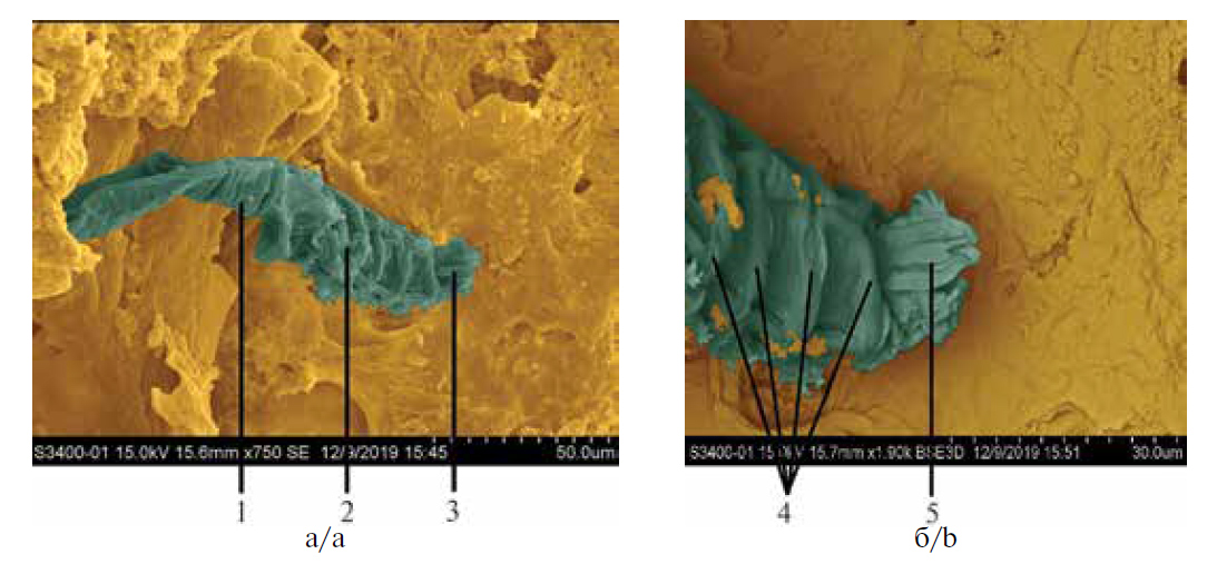 Рис 1. Микрофотографии клеща Demodex на стадии имаго, полученные методом сканирующей электронной микроскопии с последующей цветокоррекцией (аппарат Hitachi S-3400N; ×750, ×1900).