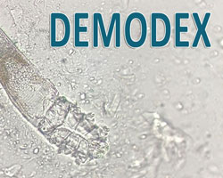 Клещ Demodex, видео, видеоматериалы, методы лечения Demodex