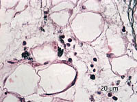 Omentum. Colloidal carbon particles in macrophages